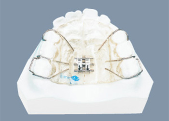 拡大装置　可撤式および固定式装置
