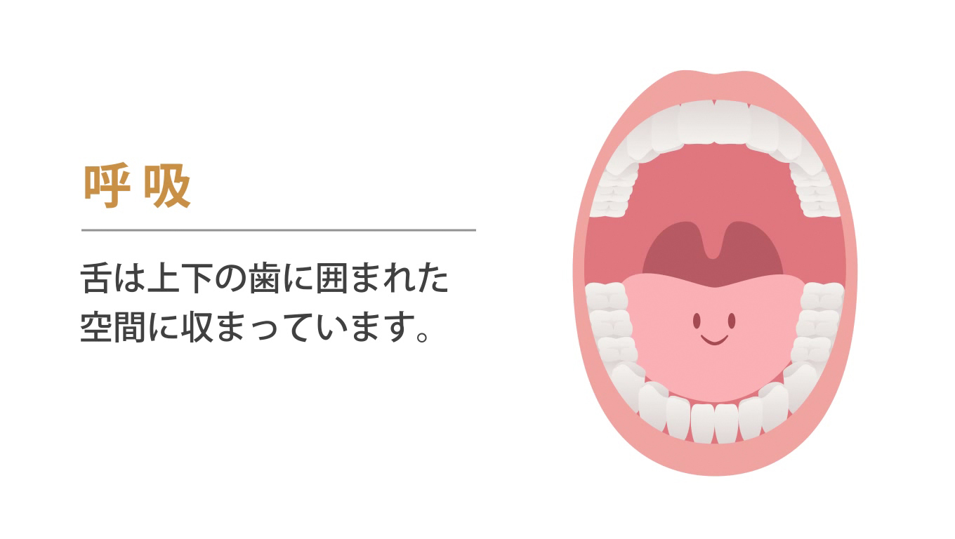 歯科矯正ランパ療法13