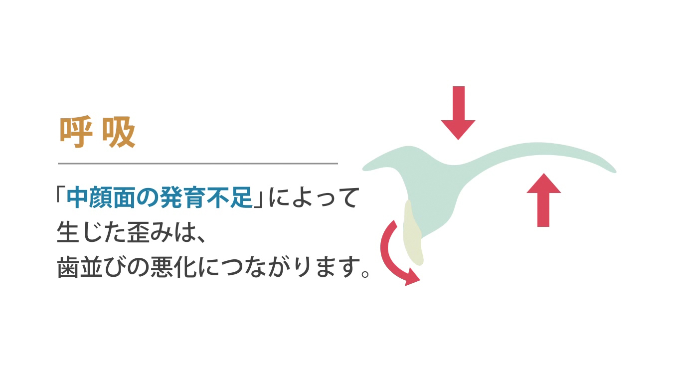 歯科矯正ランパ療法15