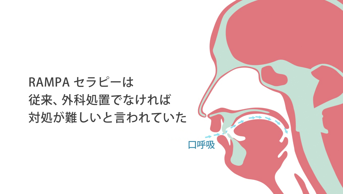 歯科矯正ランパ療法19