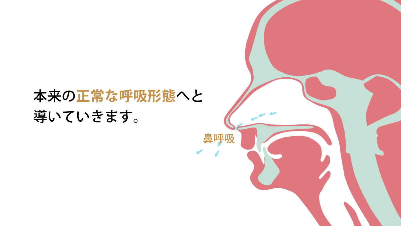 歯科矯正ランパ療法24