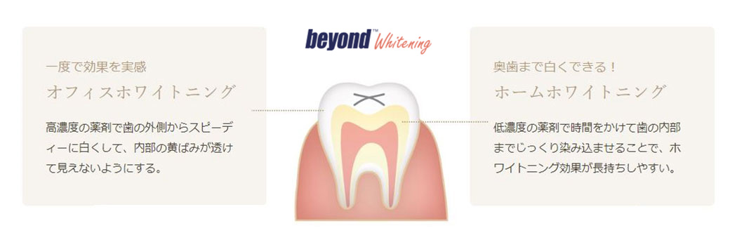 ビヨンドホワイトニング