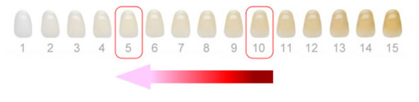 オフィスホワイトニング