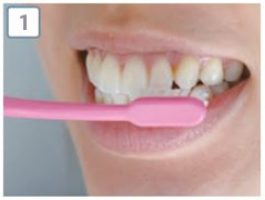 ホームホワイトニングステップ1