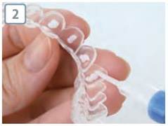 ホームホワイトニングステップ2