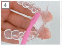 ホームホワイトニングステップ4